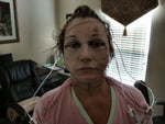 facelift day 2.jpg